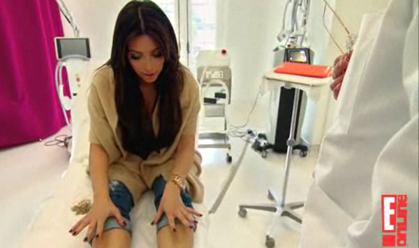 Kim Kardashian Diagnosed With Psoriasis