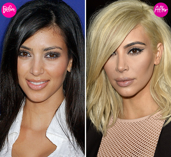 kim-kardashian-lip-injections-beauty
