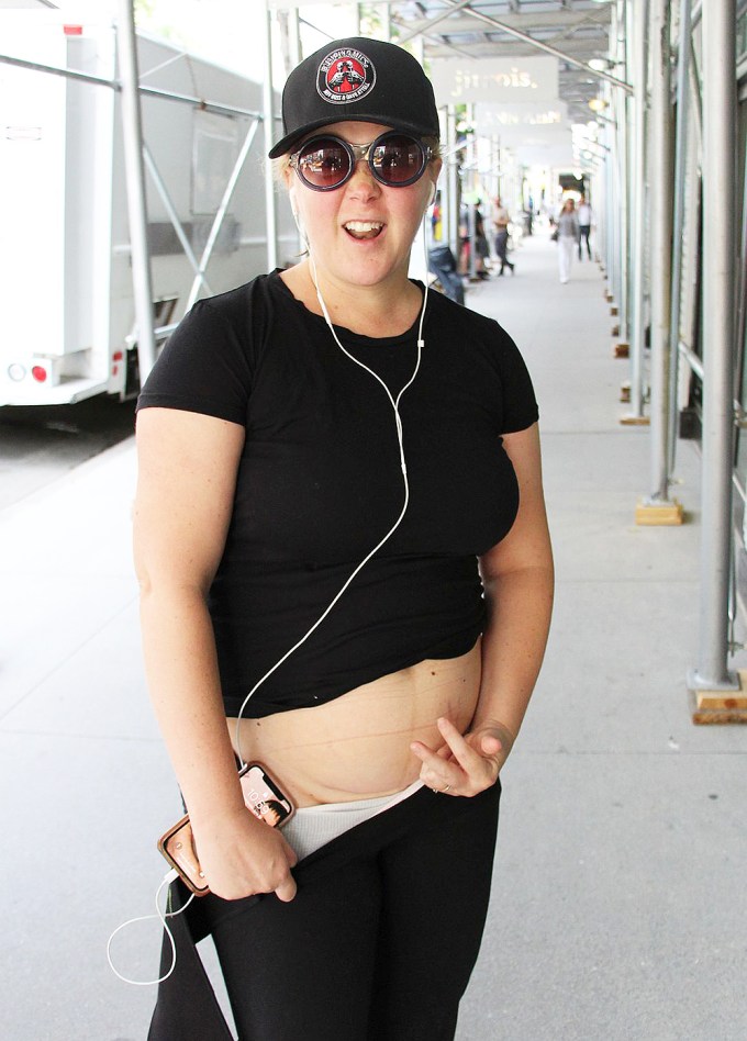 Amy Schumer Shows Off Her C-Section Scar