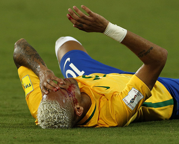 Neymar got hurt