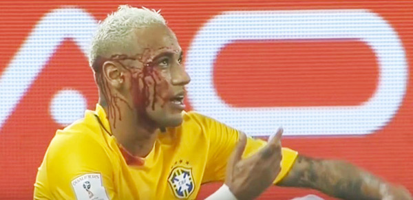 Neymar gets injured