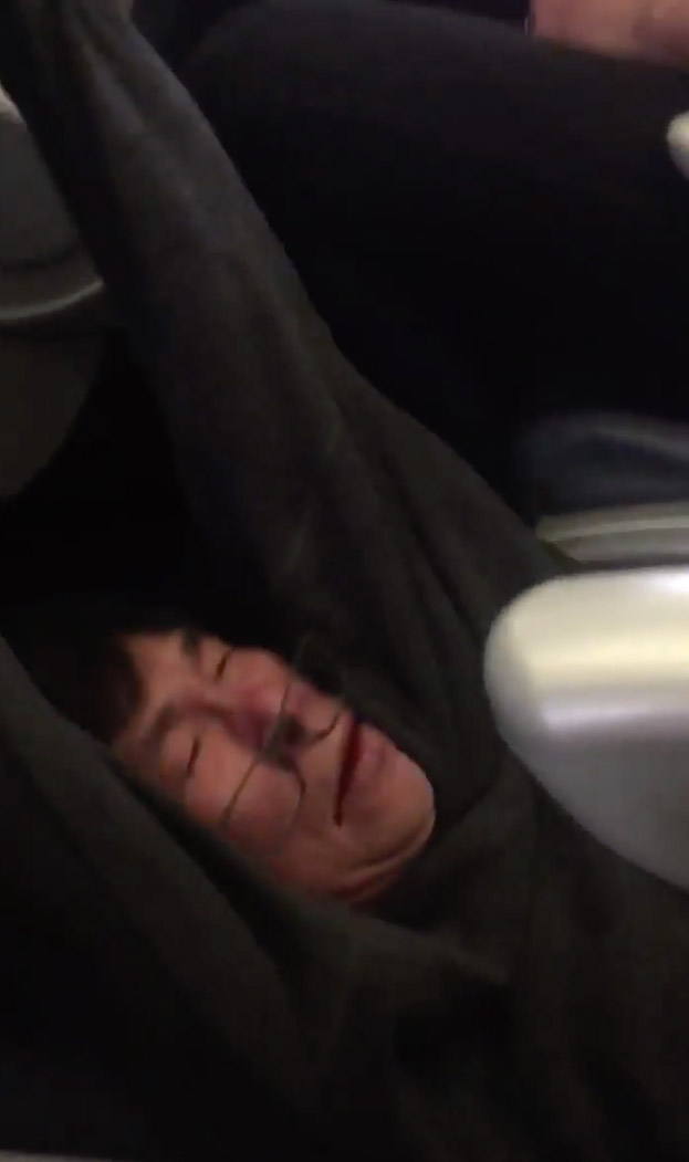United-Airlines-Shocking-Video-Passenger-Bloodied-Disoriented-15