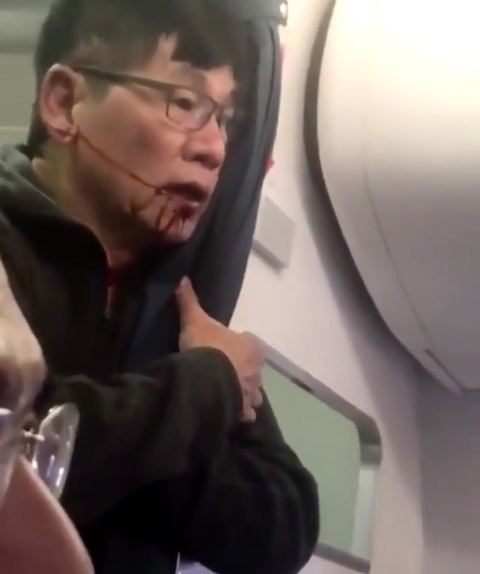 United-Airlines-Shocking-Video-Passenger-Bloodied-Disoriented-2