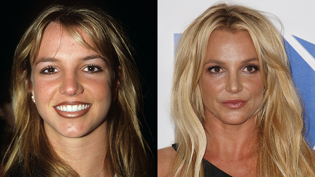 25 Stars Who Have Openly Admitted To Having Plastic Surgery: Kourtney Kardashian, Britney Spears & More