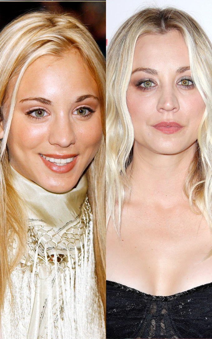 Iggy Azalea, Kaley Cuoco, and More Stars Who Have Admitted to Getting a Boob  Job – See Their Before-and-After Pics - Life & Style