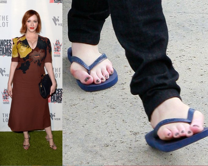 Stars With Freaky Feet & Toes