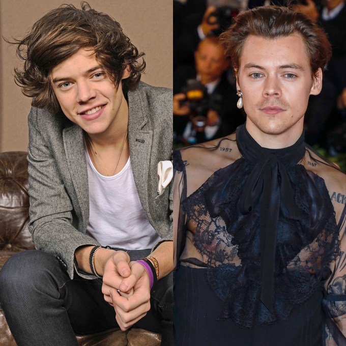 Harry Styles poses then and now