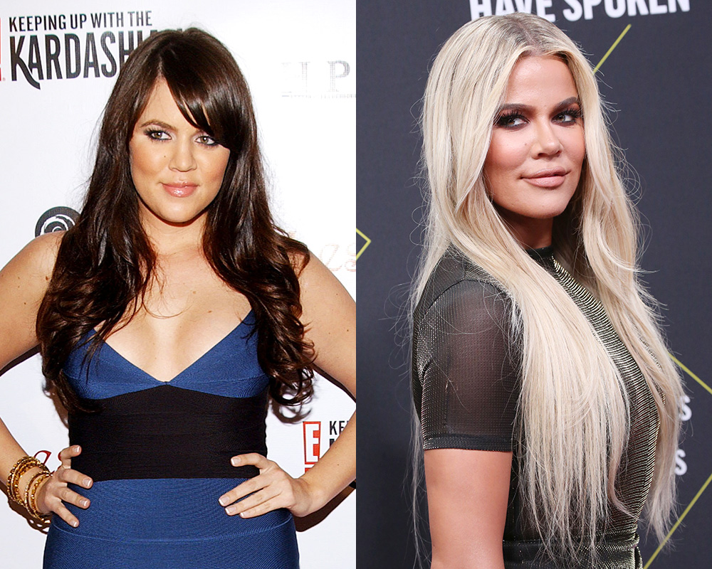 Stars Weight Loss Pics — Khloe Kardashian, Kelly Clarkson & More –  Hollywood Life