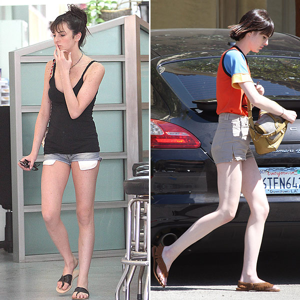 Pics Ali Lohan Skinny — Is She Anorexic See The Before And After Pic 