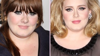 Adele Nose Job