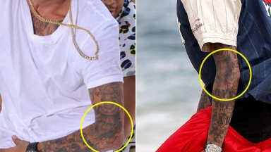 Chris Brown Tattoo Removed