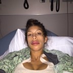 farrah-abraham-duck-lips-surgery-2