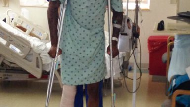 Kevin Ware X Ray