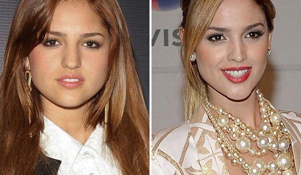 Eiza Gonzalez Plastic Surgery