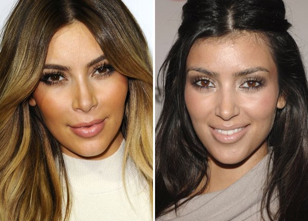 Kim Kardashian Botox — Has She Been Overdoing It With The Injections ...