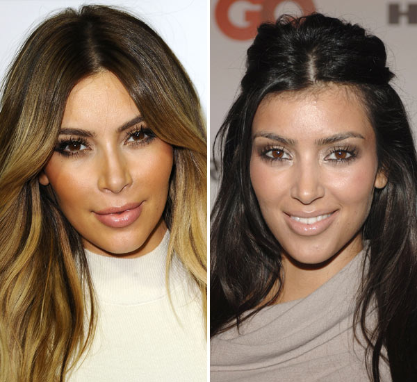 Kim Kardashian Botox — Has She Been Overdoing It With The Injections ...