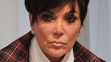 Kris Jenner Under Eye Bags