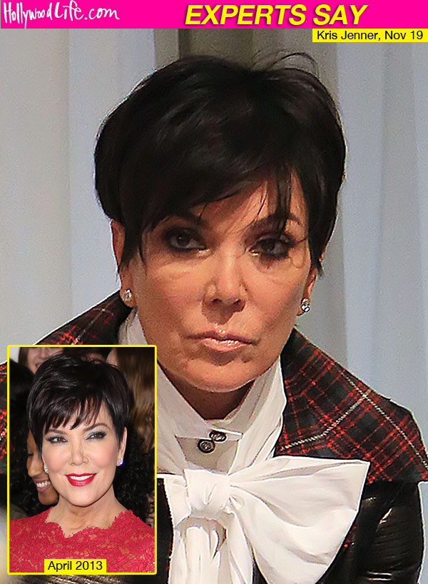 Kris Jenner Under Eye Bags
