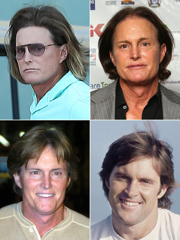 [pics] Bruce Jenner’s Plastic Surgery — A Scary Facial Transformation Hollywood Life