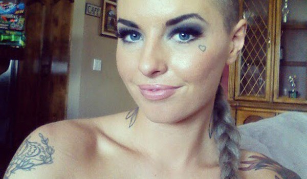 Christy Mack Recovery Facial Reconstruction