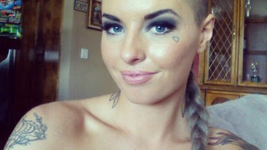 Christy Mack Recovery Facial Reconstruction