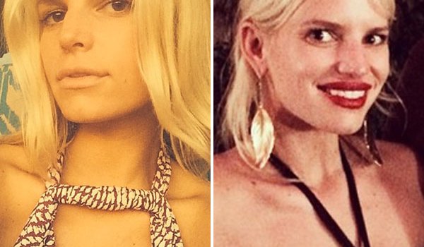 Jessica Simpson Lip Fillers