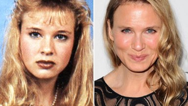 renee zellweger before after