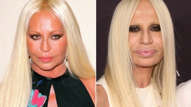 See Donatella Versace's Shocking Transformation Right Before Your Eyes -  Life & Style