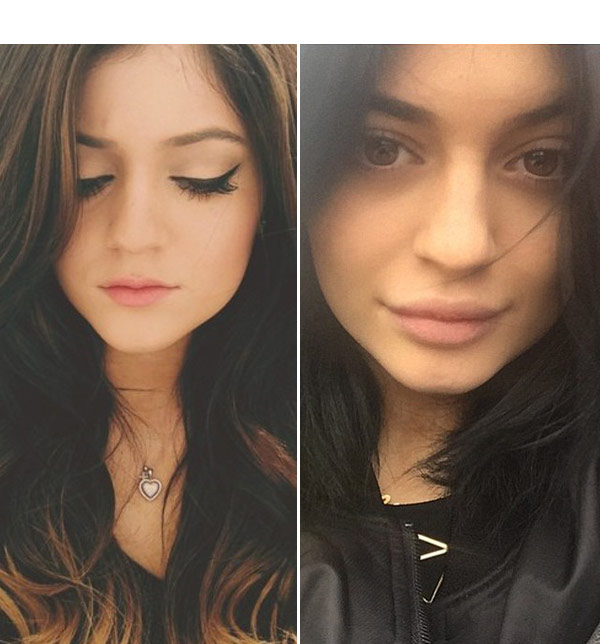 [PICS] Kylie Jenner’s Plump Lips — Check Out Before & After Photos ...