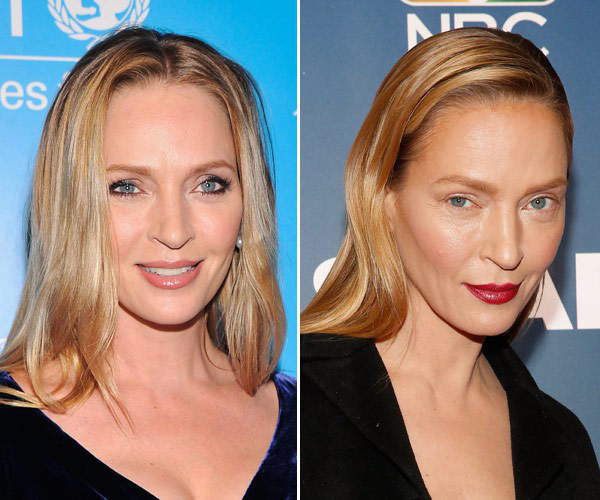 Did Uma Thurman Get Plastic Surgery? — Experts Give Their ...