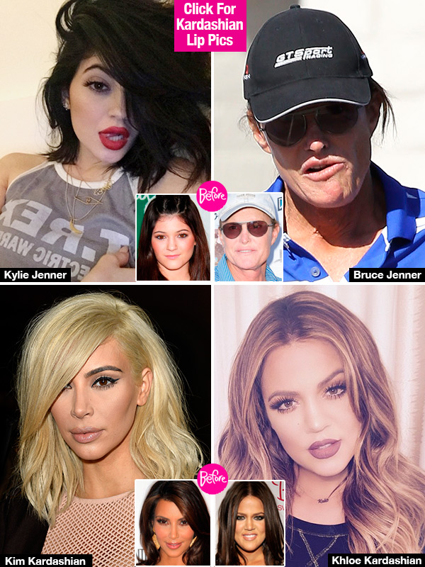 Bruce Jenner Plastic Surgery