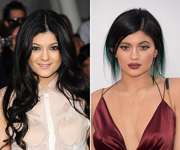 Kylie Jenner Too Young For Lip Fillers Doctor Speaks Out Hollywood Life