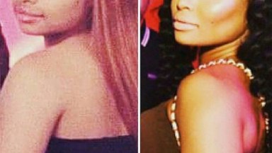 Blac Chyna Plastic Surgery