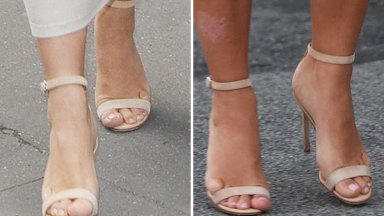 kim kardashian swollen feet