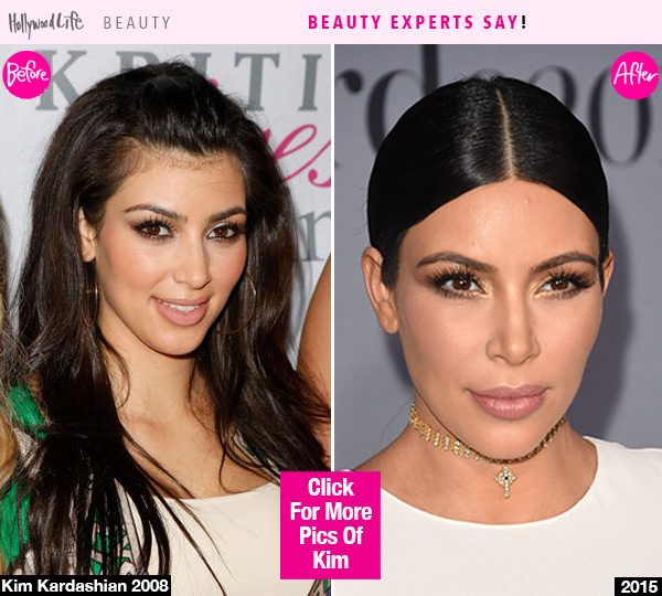 kim kardashian hair removal beauty before after lead