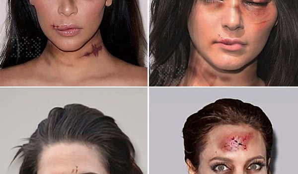 Kendall Jenner Domestic Abuse Campaign