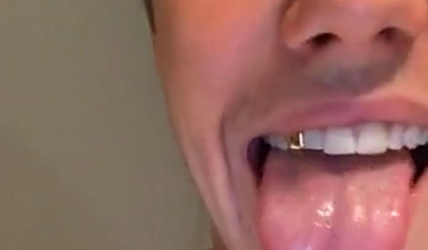 Justin Bieber Gold Tooth