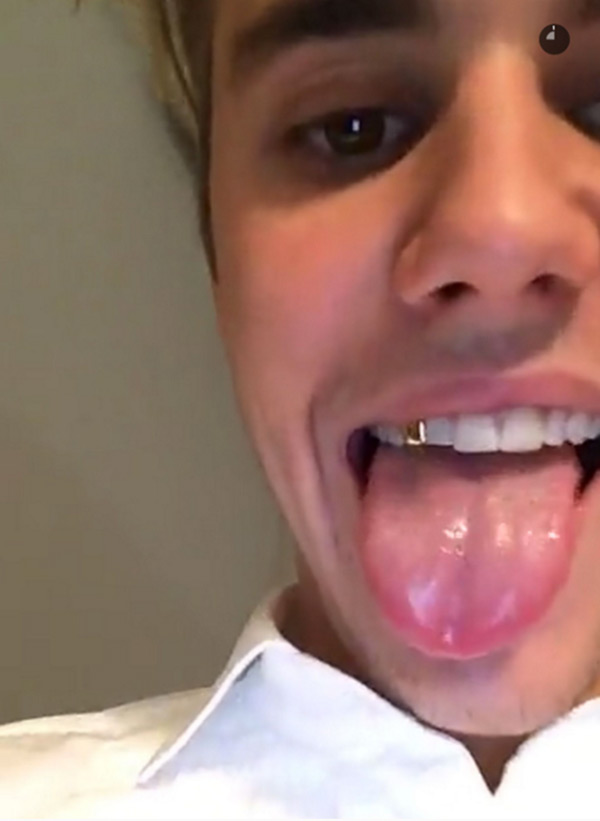 [PIC] Justin Bieber’s Gold Tooth — See Biebs’ New Mouth Jewelry