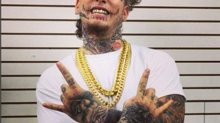 Stitches Bio