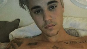 Justin Bieber Cupping