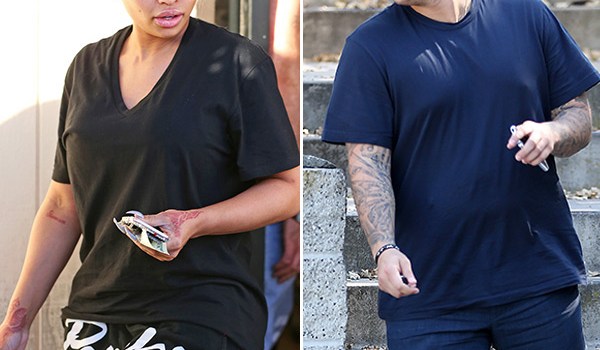 Rob Kardashian Gastric Bypass Surgery