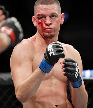 Nate Diaz