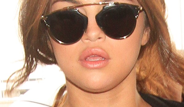 Selena Gomez Lip Fillers