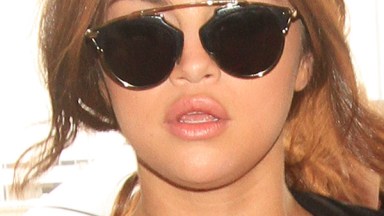 Selena Gomez Lip Fillers