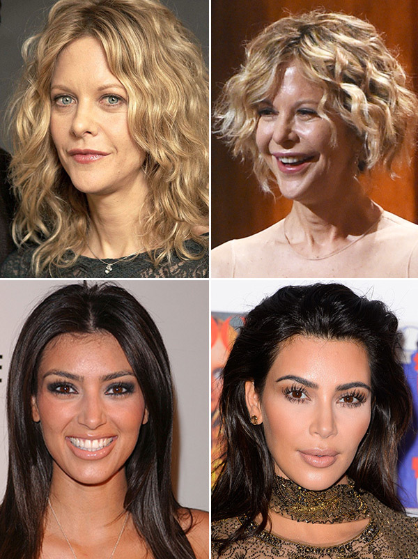 [PICS] Celebrities Whose Faces Changed: Meg Ryan, Kim Kardashian & More ...