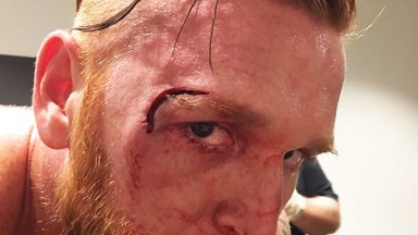 Heath Slater Head Injury