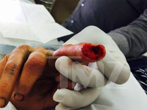Johnny Depp Cut Off Finger