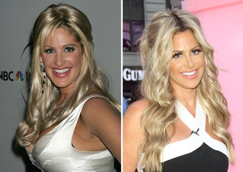 [PICS] Celebrities Before & After Plastic Surgery: Photos Of The ...