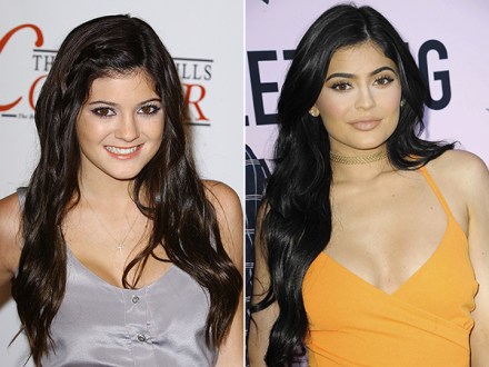 Celebrities Before After Plastic Surgery Photos