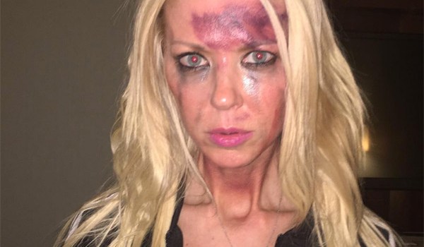 Tara Reid Bruised Face